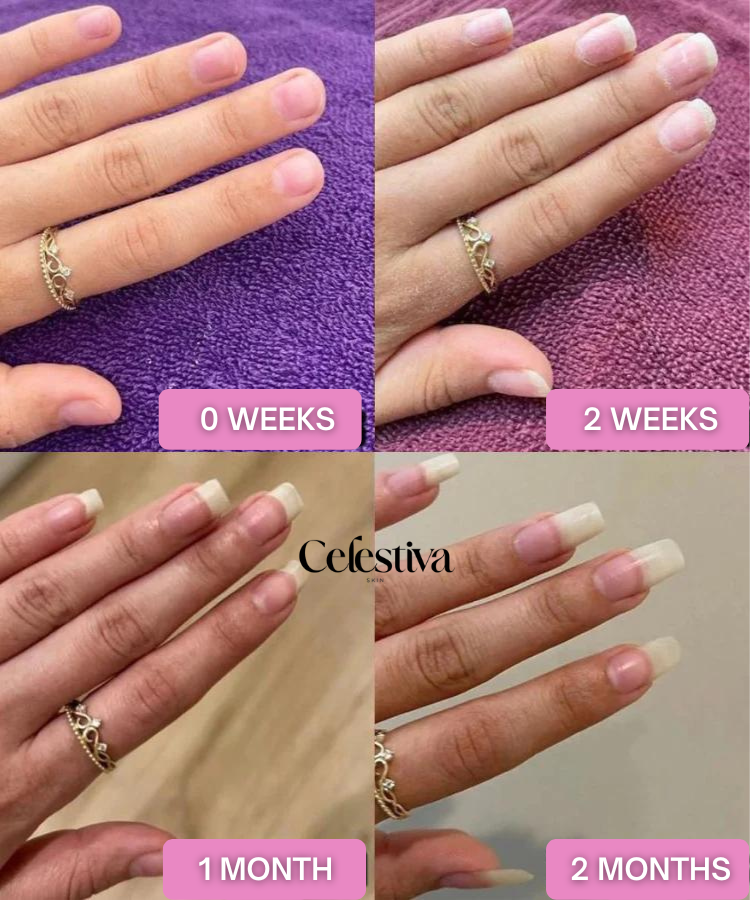 Gloessence Nail – Strengthen and Accelerate the Growth of Your Nails