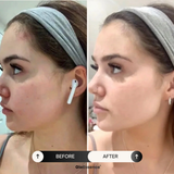 EssenceLift™ – Firm and Rejuvenate Your Skin