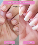 Gloessence Nail – Strengthen and Accelerate the Growth of Your Nails