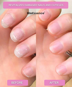 Gloessence Nail – Strengthen and Accelerate the Growth of Your Nails