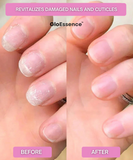 Gloessence Nail – Strengthen and Accelerate the Growth of Your Nails